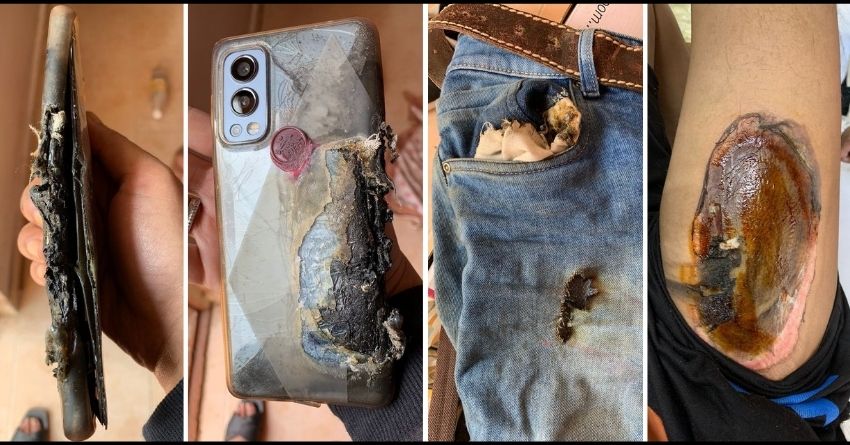 OnePlus Nord 2 5G Reportedly Explodes Causing Severe Burns to the Owner